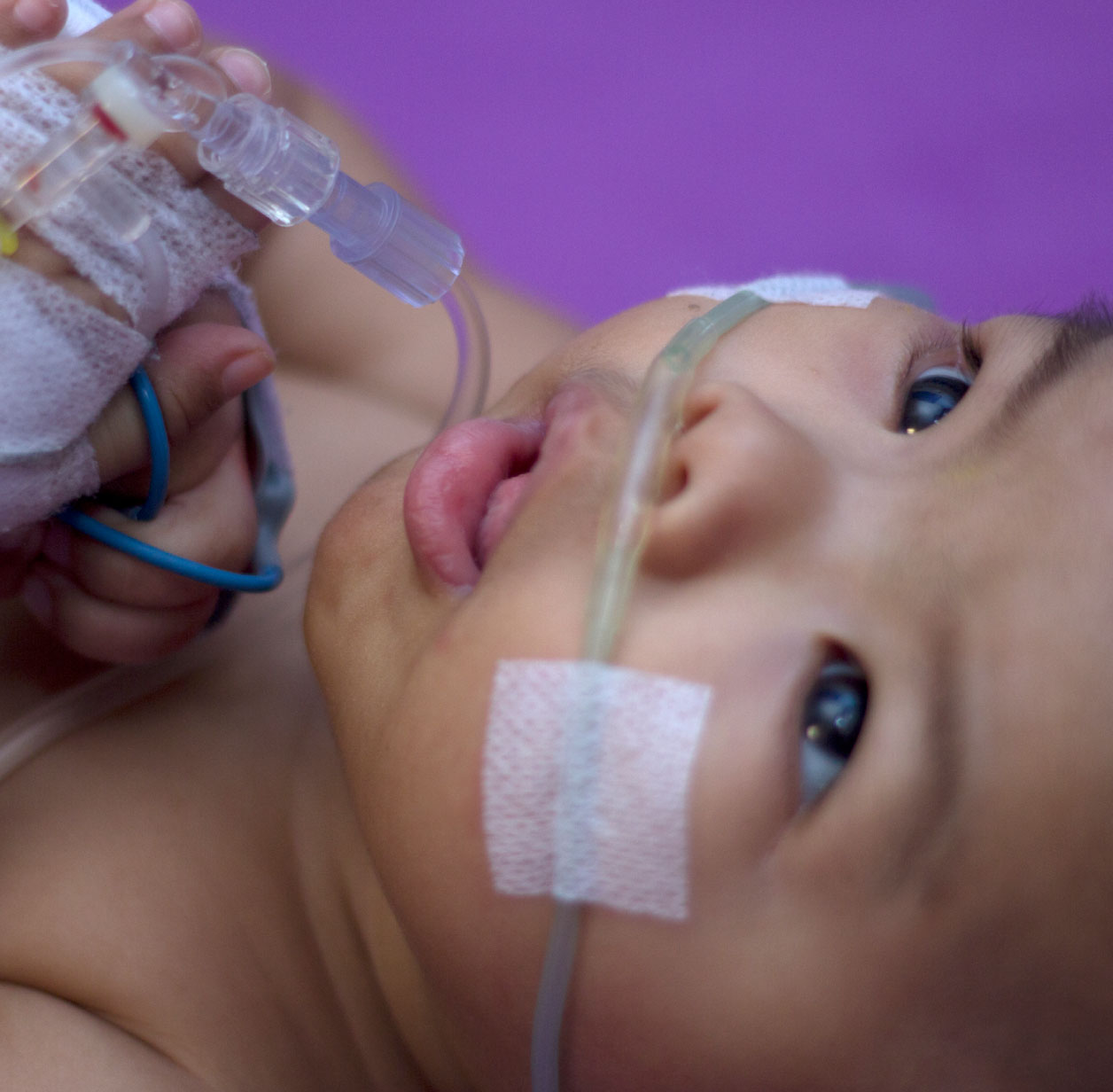 Child-4 Pediatric Asthma